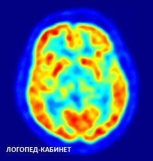 Потребление энергии в зонах мозга /Логопед-Кабинет/ Потребление энергии в зонах мозга /Логопед-Кабинет/